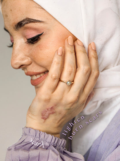 ScarX - PU Backed Silicone Scar Reducing Sheets