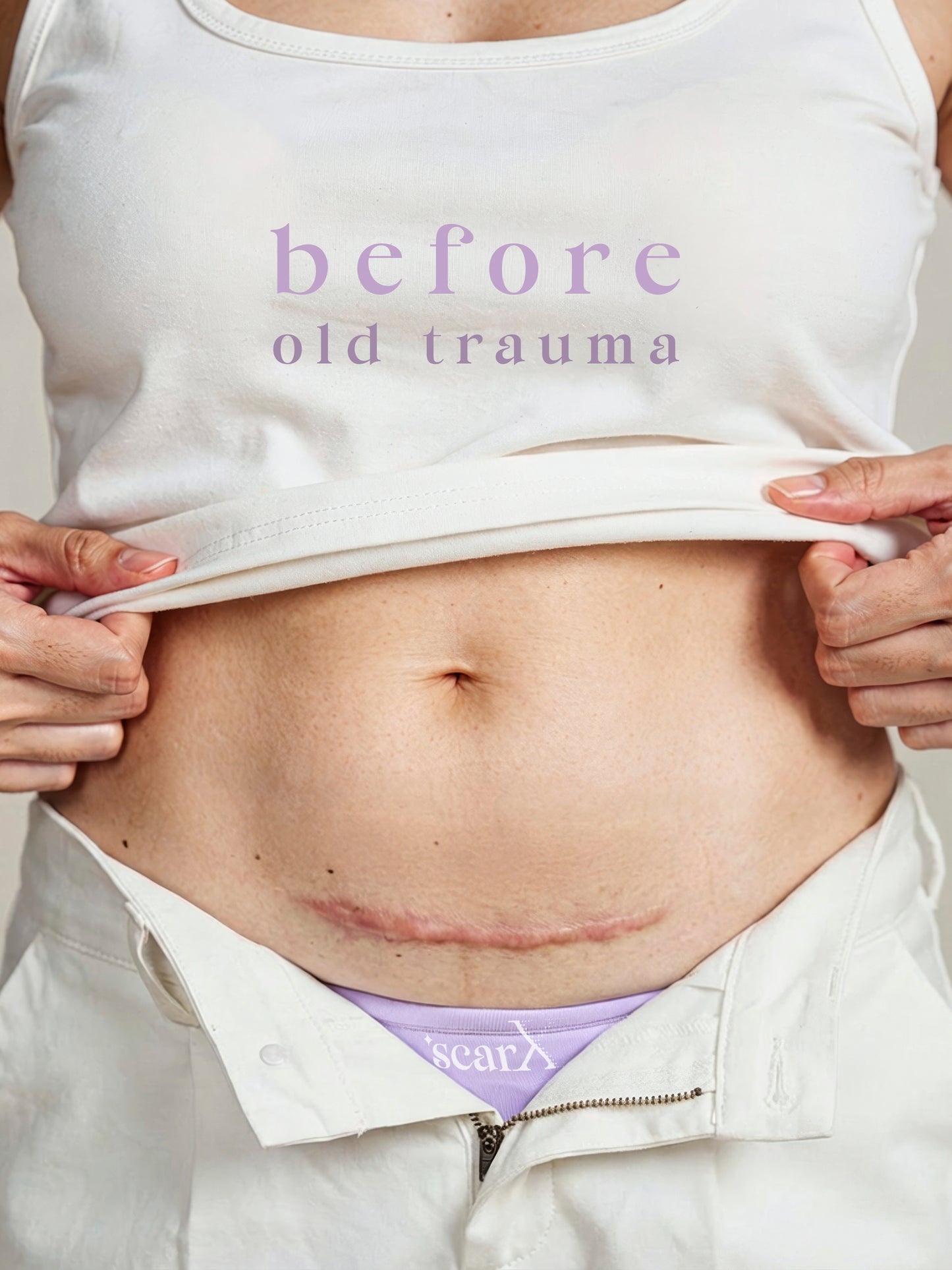 ScarX - PU Backed Silicone Scar Reducing Sheets