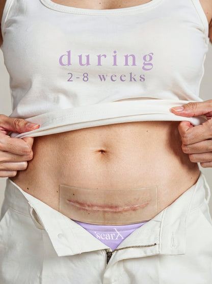 ScarX - PU Backed Silicone Scar Reducing Sheets